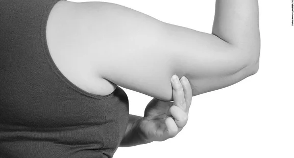 armswelling